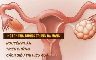 Buồng trứng đa nang