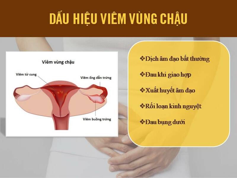 Các triệu chứng viêm vùng chậu điển hình