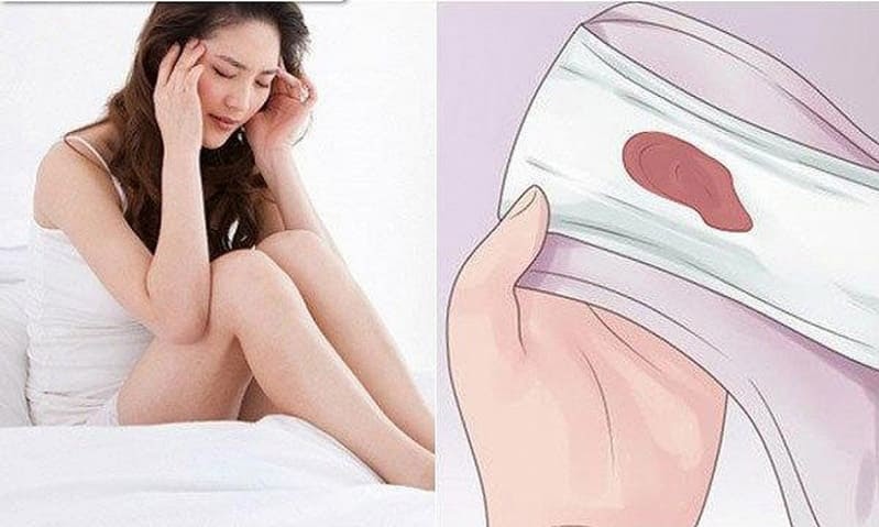 Kinh nguyệt ra ít là dấu hiệu rối loạn kinh nguyệt