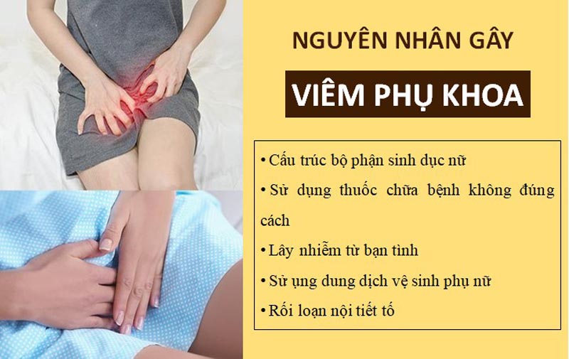 Nguyên nhân viêm phụ khoa