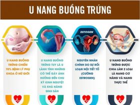 U nang buồng trứng