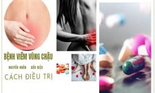 Viêm Vùng Chậu: Nguyên Nhân, Triệu Chứng Và Cách Điều Trị Bệnh