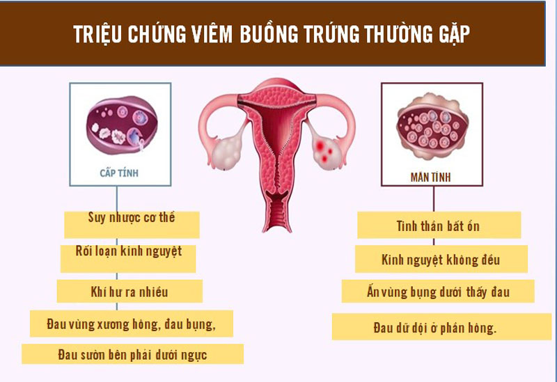 Triệu chứng viêm buồng trứng