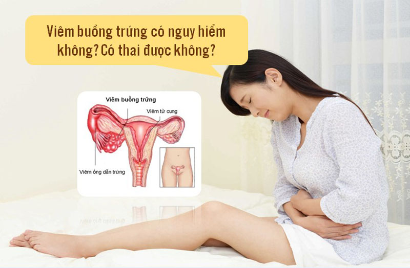 Viêm buồng trứng có nguy hiểm không? Có thai được không là thắc mắc của nhiều chị em