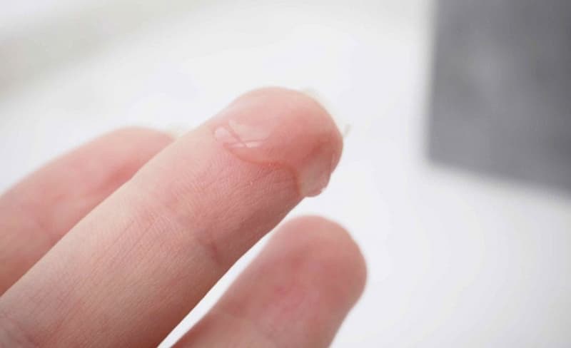 Khí hư là chất dịch trong suốt tiết ra từ âm đạo người phụ nữ
