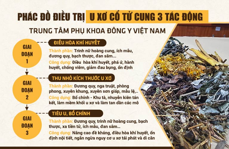 Phác đồ chữa u xơ cổ tử cung tại Trung tâm Phụ Khoa Đông y Việt Nam