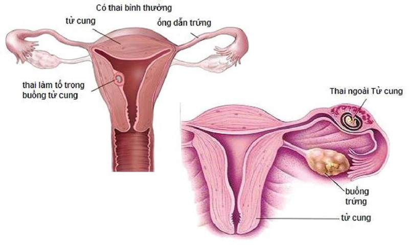 Có nhiều cách thức chẩn đoán bệnh