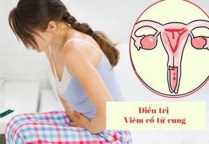 Điều trị viêm cổ tử cung cách nào tốt?