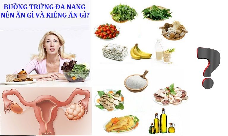 Ăn uống kiêng khem hợp lý để hỗ trợ điều trị đa nang buồng trứng