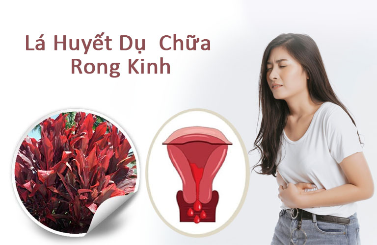 Lá huyết dụ chữa rong kinh có hiệu quả không?