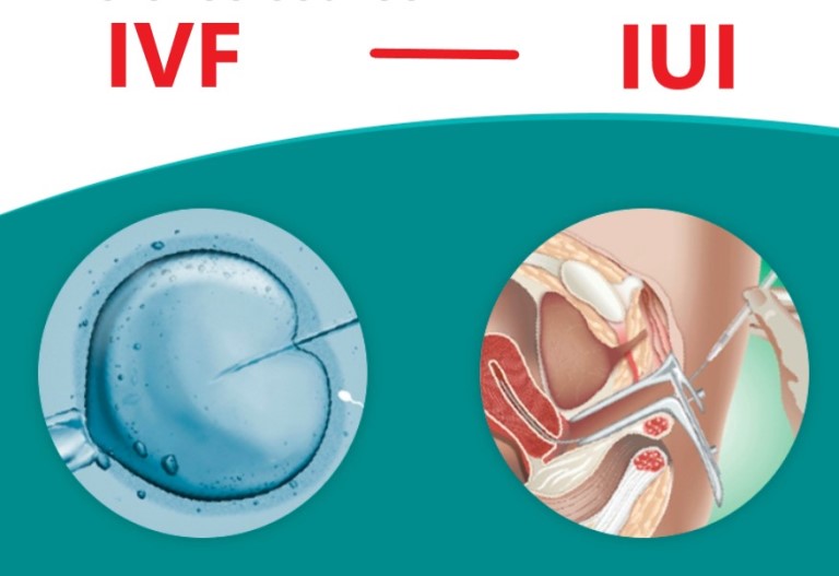 So với IUI thì IVF giúp chữa được nhiều đối tượng bệnh hơn