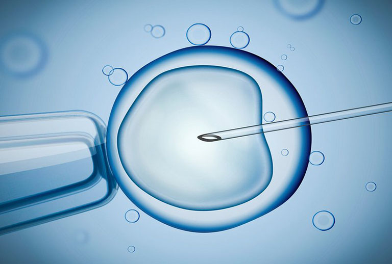 Thụ tinh nhân tạo là biện pháp tiên tiến giúp phụ nữ bị tắc vòi trứng mà vẫn có thai