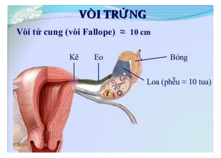 Đoạn bóng của vòi trứng có vị trí quan trọng nên rất dễ bị tắc nghẽn