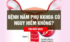Bệnh nấm phụ khoa có nguy hiểm không, sự thật khiến chị em lo lắng