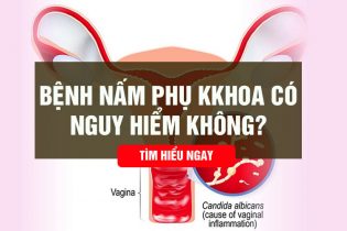 Bệnh nấm phụ khoa có nguy hiểm không