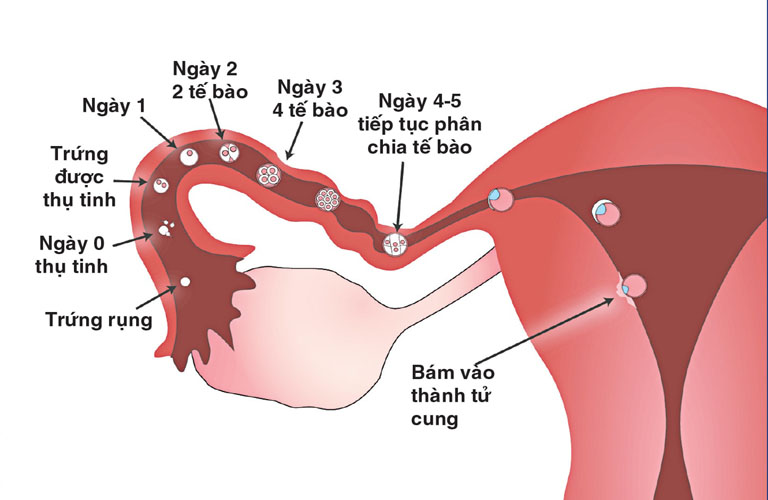 Huyết trắng có lẫn sợi máu khi mang thai là dấu hiệu trứng làm tổ thành công