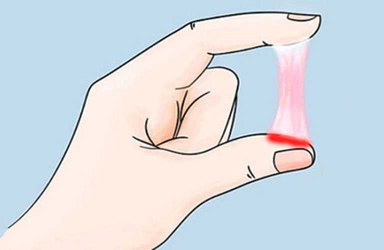 Huyết trắng ra nhiều kèm vết màu hồng có thể là dấu hiệu chuyển dạ sinh con