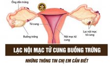 Lạc Nội Mạc Tử Cung Buồng Trứng Là Bệnh Gì? Có Nguy Hiểm Không?