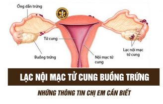 Lạc nội mạc tử cung buồng trứng là bệnh gì? Có nguy hiểm không?