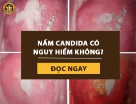 Nấm candida có nguy hiểm không, chữa thế nào hiệu quả?