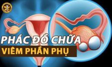 Phác Đồ Điều Trị Viêm Phần Phụ Được Áp Dụng Nhiều Nhất 2022