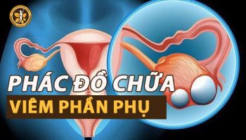 Những phác đồ điều trị viêm phần phụ được áp dụng nhiều nhất 2021