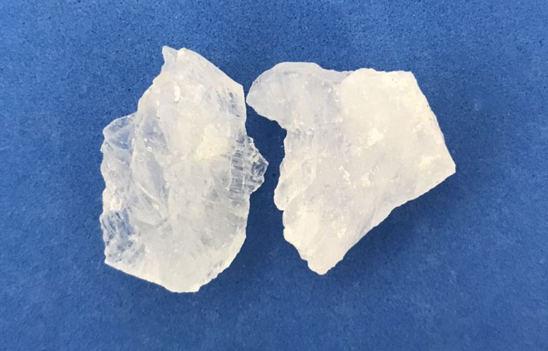 Cách trị huyết trắng bằng phèn chua khá đơn giản Cách trị huyết trắng bằng phèn chua khá đơn giản