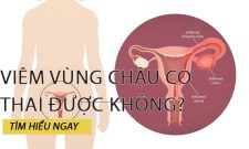 Viêm Vùng Chậu Có Thai Được Không? Cần Làm Gì Khi Mắc Bệnh?