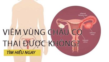 Viêm Vùng Chậu Có Thai Được Không? Cần Làm Gì Khi Mắc Bệnh?