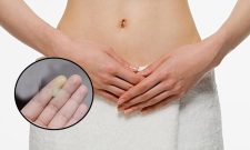 Huyết Trắng Đục Sệt Là Do Đâu? Có Nguy Hiểm Không?