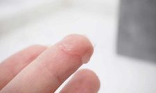 Huyết Trắng Ra Ít Có Sao Không? Khắc Phục Thế Nào?