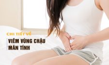 [Chi Tiết] Viêm vùng chậu mãn tính là gì? Triệu chứng, nguyên nhân và cách điều trị