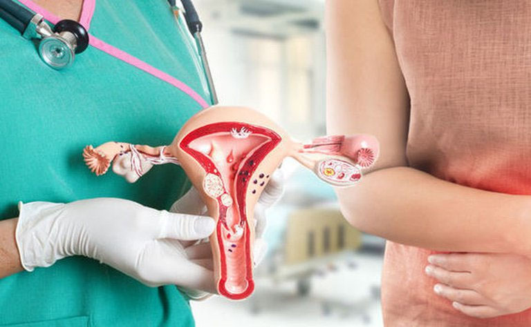 Một số bệnh lý phụ khoa nguy hiểm có thể gây ra huyết trắng kèm đau lưng âm ỉ
