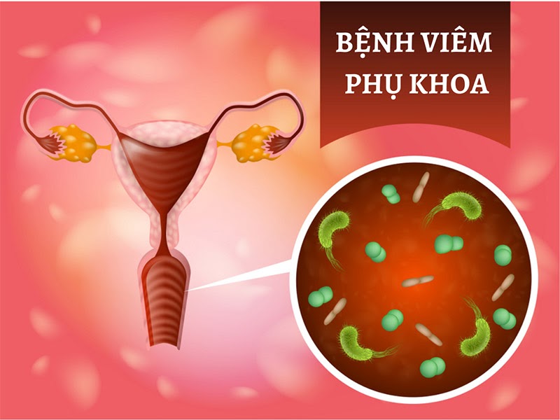 Bệnh phụ khoa là các bệnh lý liên quan đến cơ quan sinh dục nữ