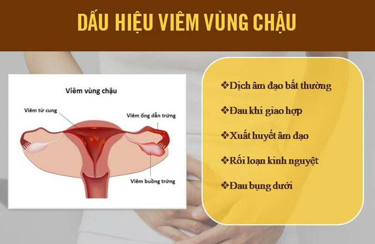 Một số triệu chứng viêm vùng chậu điển hình