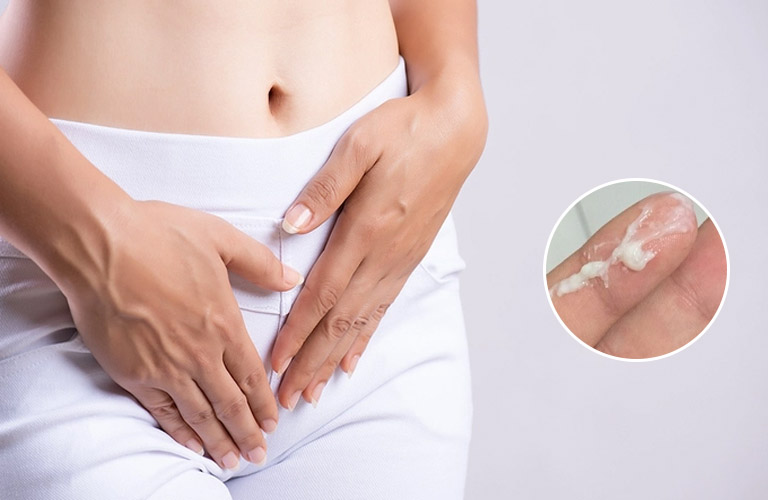 Huyết trắng vón cục có thể là dấu hiệu viêm nhiễm phụ khoa